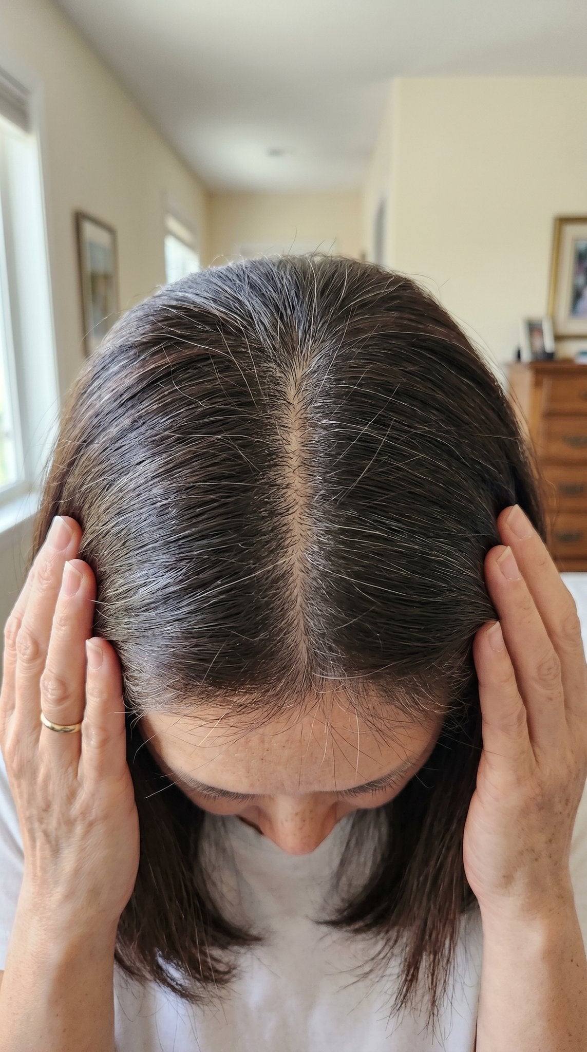 https://cdn.shopify.com/s/files/1/1009/7124/9986/files/ugc-topdown-scalp-thinning-part-closeup.jpg?v=1779475767